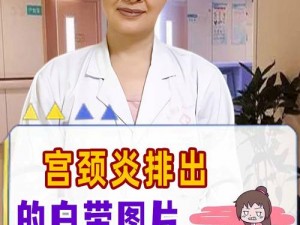 白带滴出来呈现乳白色，是女性生殖系统健康的重要指标