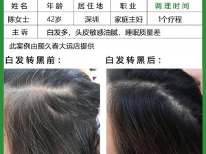 女幸的秘密花园有了白发不用怕，试试[]，让你重拾自信