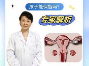 怎么才能让妈妈不怀孕——一款有效的避孕产品