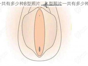 一共有多少种B型照片、B 型照片一共有多少种？