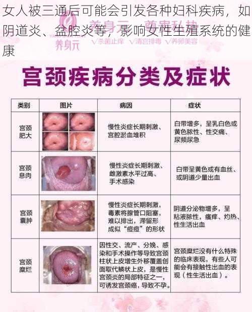 女人被三通后可能会引发各种妇科疾病，如阴道炎、盆腔炎等，影响女性生殖系统的健康