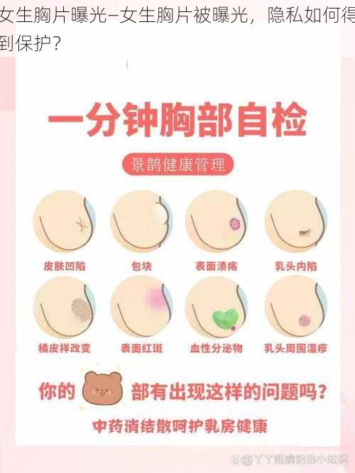 女生胸片曝光—女生胸片被曝光，隐私如何得到保护？